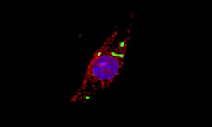 Microscopic image showing a macrophage that has been infected with Salmonella (green), causing cellular cathepsins (red) to locate to the nucels (blue).